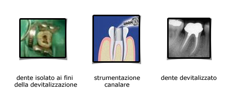 Endodonzia